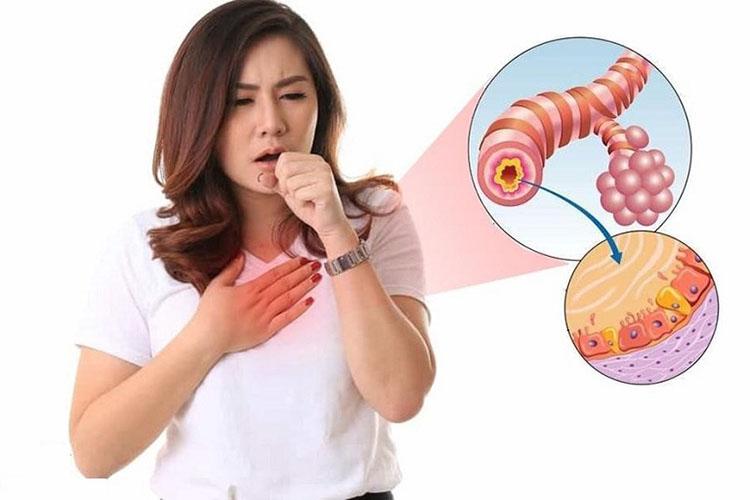 Ho nhiều ngày không khỏi có thể là do bệnh viêm phế quản mãn tính gây ra