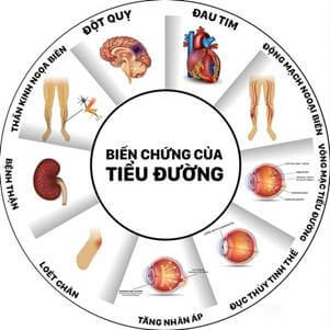 Biến chứng mạn tính của đái tháo đường