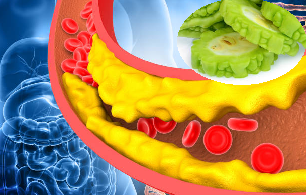 Mướp đắng giúp giảm cholesterol, phòng ngừa bệnh tim mạch