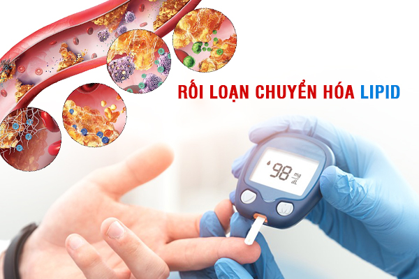 Điều trị rối loạn chuyển hóa lipid máu ở người bệnh tiểu đường