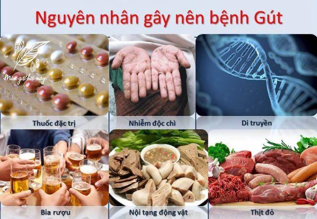 Một số nguyên nhân gây bệnh gút