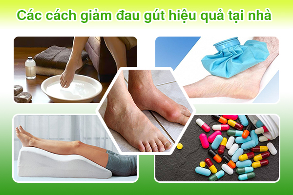 Các cách làm giảm đau gút hiệu quả tại nhà