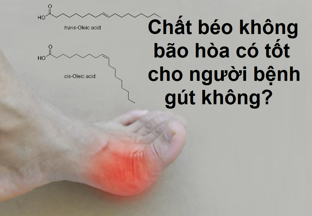 Chất béo không bão hòa có tốt cho người bệnh gút không?