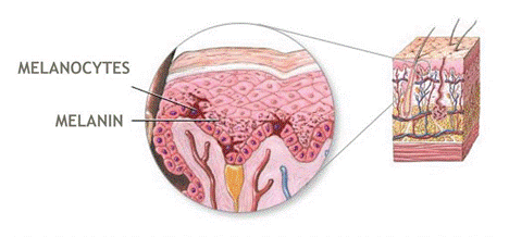 Sự suy giảm sắc tố melanin gây bạc tóc