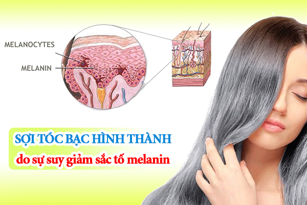 Sợi tóc bạc hình thành do sự suy giảm sắc tố melanin