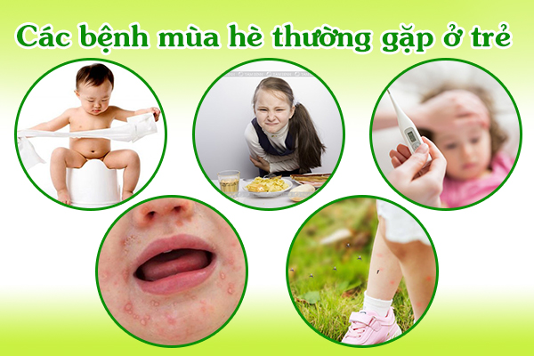 Các bệnh mùa hè thường gặp ở trẻ là gì?