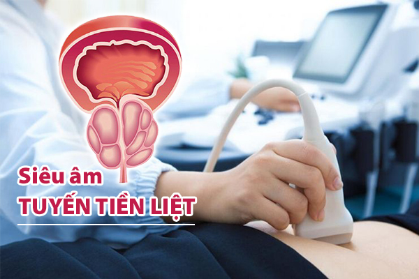 Mục đích của việc siêu âm tuyến tiền liệt là gì?