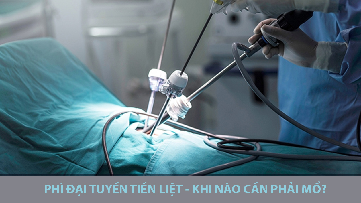 Phì đại tuyến tiền liệt: Khi nào cần phải phẫu thuật?