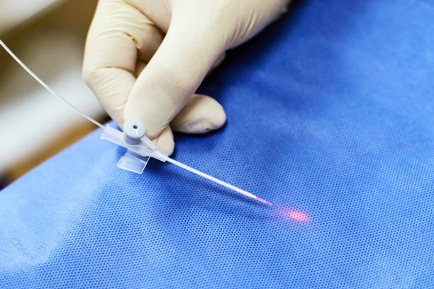 Phương pháp laser nội tĩnh mạch