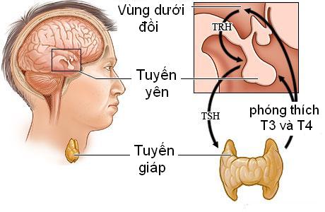 Nguyên nhân bạc tóc do bệnh lý