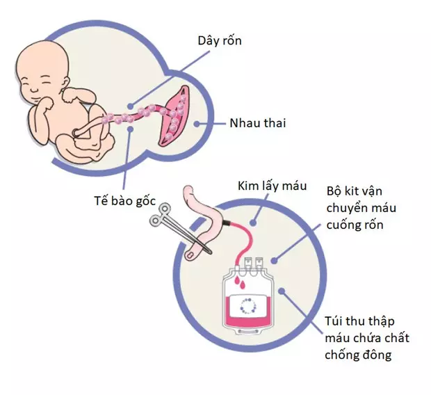 Tế bào gốc nhũ nhi