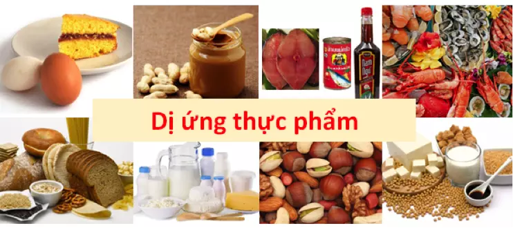 Đừng nhầm lẫn giữa dị ứng thực phẩm và không dung nạp thức ăn