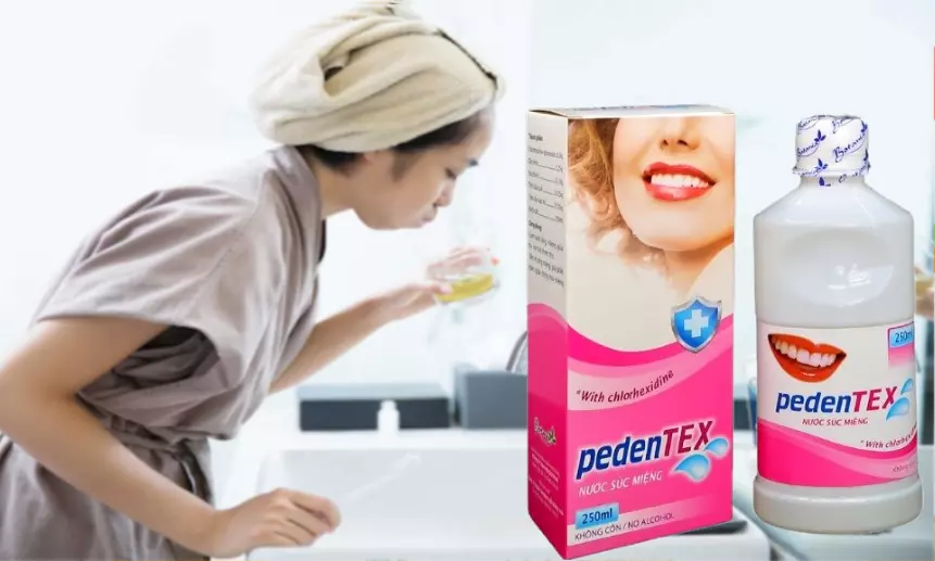 Dùng nước súc miệng Pedentex để giảm nhiệt miệng