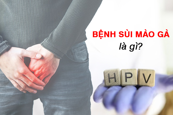 Bệnh sùi mào gà là gì? Dấu hiệu, triệu chứng, cách điều trị và phòng tránh