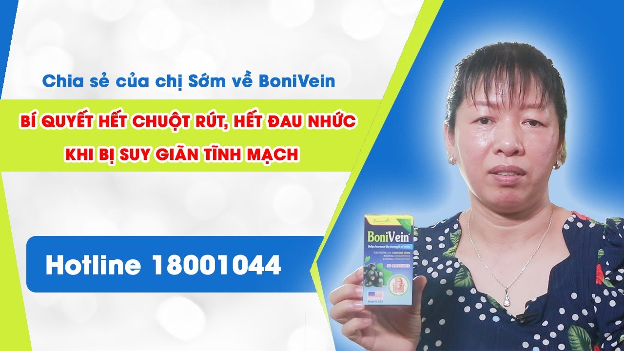 Đẩy lui suy giãn tĩnh mạch không ngờ lại dễ dàng đến thế