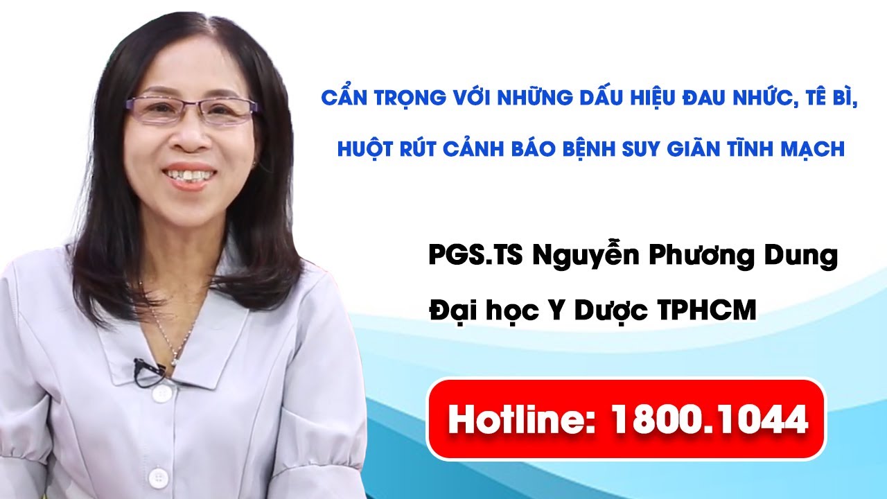 THVL1: Cẩn trọng với những dấu hiệu đau nhức, tê bì, chuột rút cảnh báo bệnh suy giãn tĩnh mạch