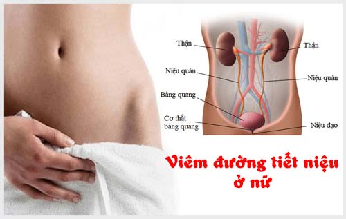 Tổng quan về viêm đường tiết niệu và giải pháp